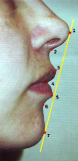 Красивые губы: эстетическая линия Риккетса